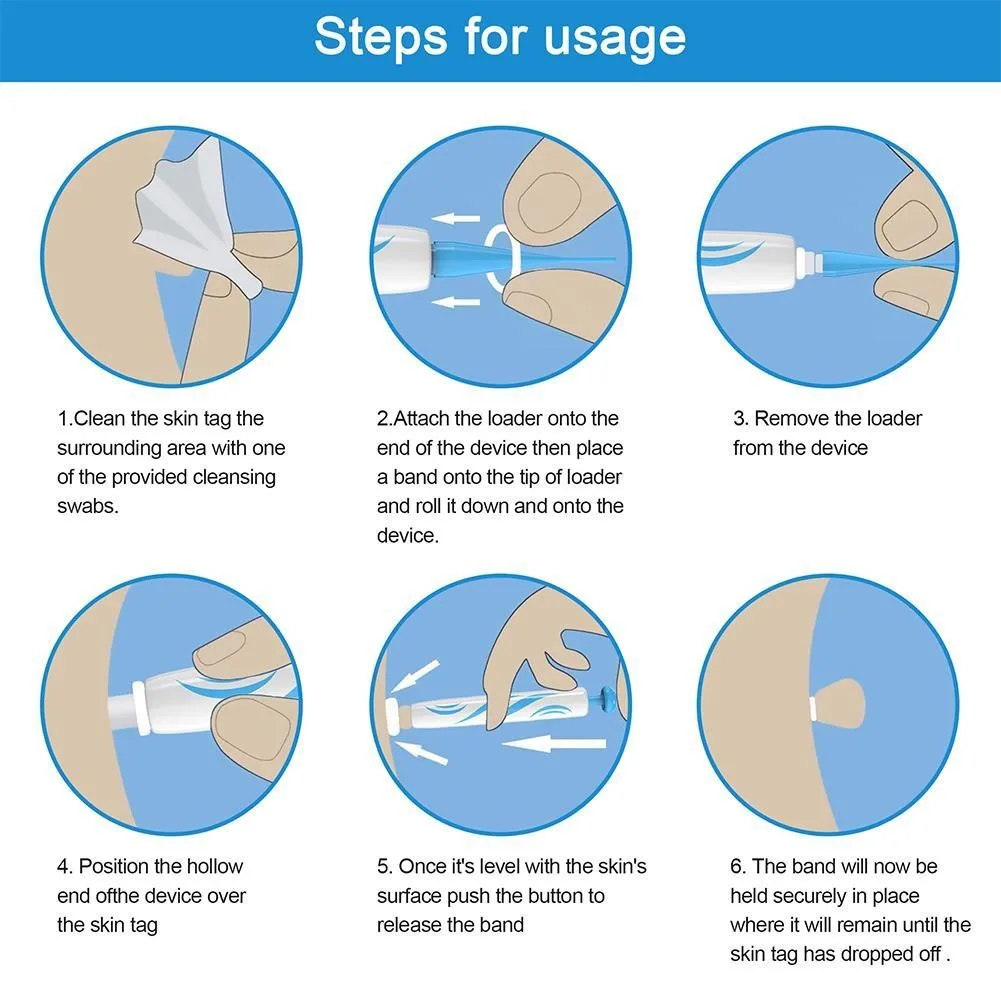 Auto Skin Tag Remover Painless Facial Beauty Tools Mole Wart