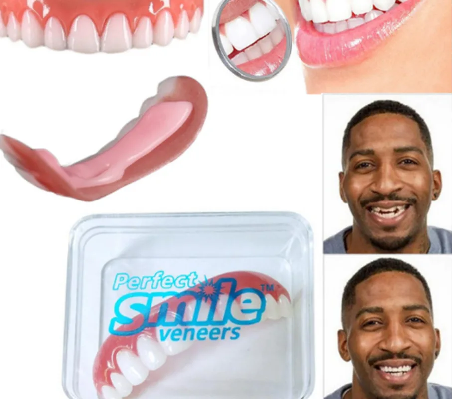 Professional Correction Of Bad Teeth Perfect Smile Veneer